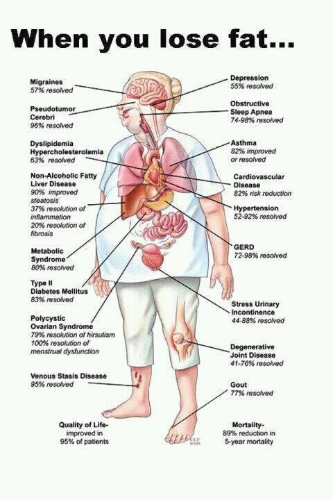 Benefits of losing weight