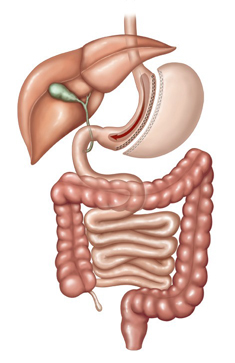 gastric sleeve  loss surgery