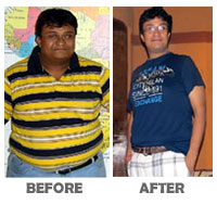 success-stories-before-after-sumant
