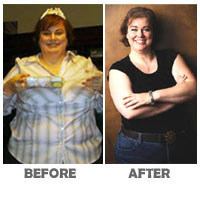 success-stories-before-after-lynne