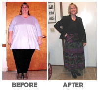 success-stories-before-after-dione