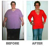 success-stories-before-after-sandra-r
