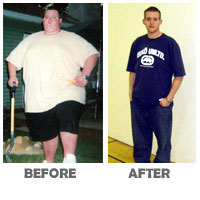 success-stories-before-after-ryand