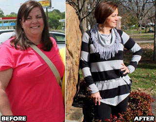 melissa-c-weight-loss-story-1