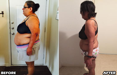 magdalena-weight-loss-story-3