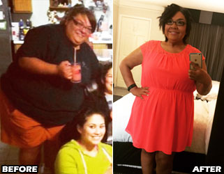 magdalena-weight-loss-story-4