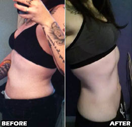 holly-s-weight-loss-story-3