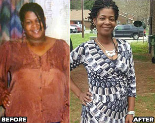 beverly-weight-loss-story-2
