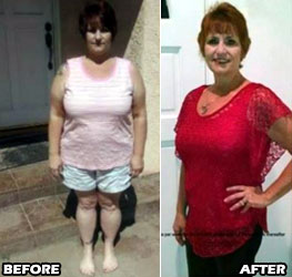 stacie-weight-loss-story-3