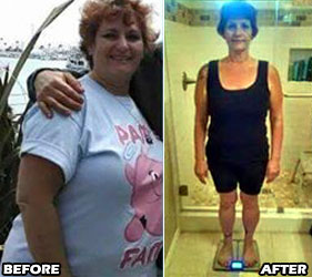 stacie-weight-loss-story-2