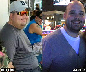 richard-a-weight-loss-story-3