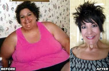 lori-o-weight-loss-story-4