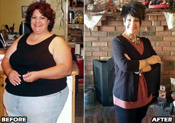 lori-o-weight-loss-story-3