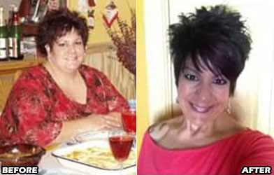 lori-o-weight-loss-story-5