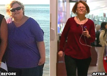 jill-v-weight-loss-story-2