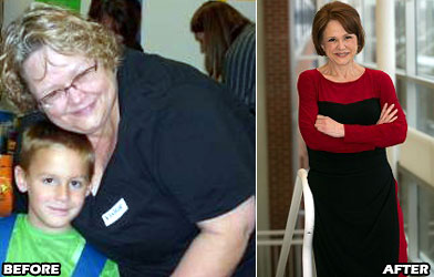 jill-v-weight-loss-story-3