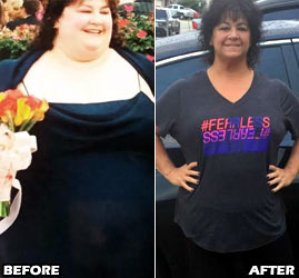 michele-m-weight-loss-story-3