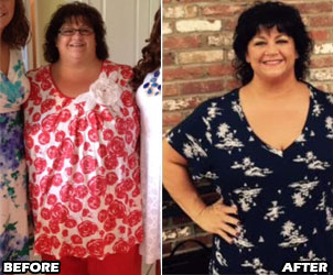 michele-m-weight-loss-story-1