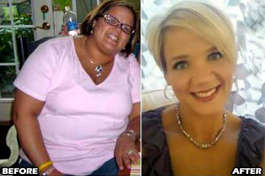 lynn-c-weight-loss-story-2