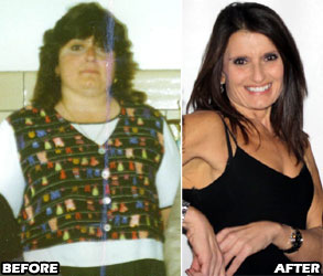 susan-weight-loss-story-2