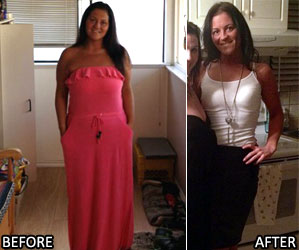 diana-r-weight-loss-story-5
