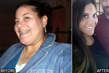 christina-r-weight-loss-story-2