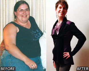 amy-m-weight-loss-story-1