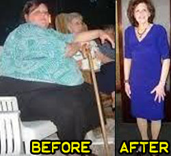 theresa-weight-loss-story-2