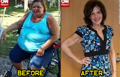 theresa-weight-loss-story-1