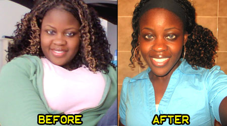 sylvia-weight-loss-story-1