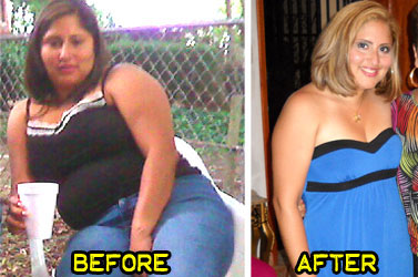 ruth-weight-loss-success-story-1