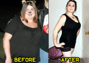 melissa-p-weight-loss-story-2