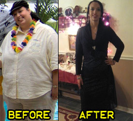 laura-h-weight-loss-story-1