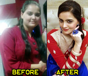 kiranjot-weight-loss-story-2