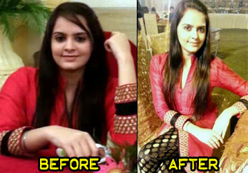 kiranjot-weight-loss-story-1