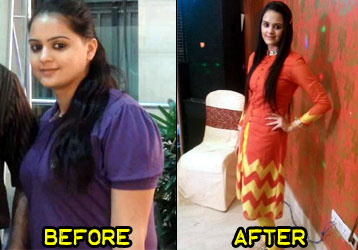 kiranjot-weight-loss-story-3