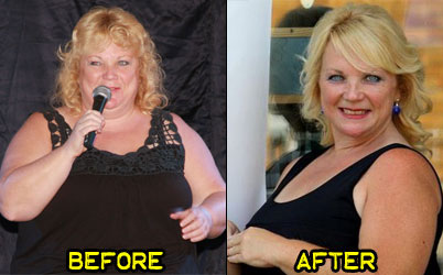 joan-weight-loss-story-2