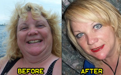 joan-weight-loss-story-3