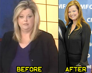 janie-w-weight-loss-story-1