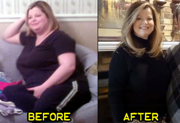 janie-w-weight-loss-story-2