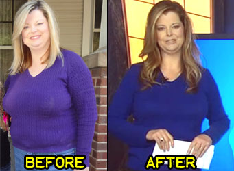 janie-w-weight-loss-story-3