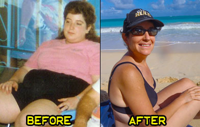 elizabeth-b-weight-loss-story-1