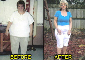 corinna-weight-loss-story-2