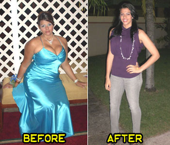 barbara-weight-loss-story-1