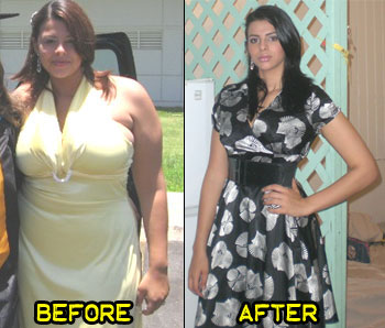 barbara-weight-loss-story-3