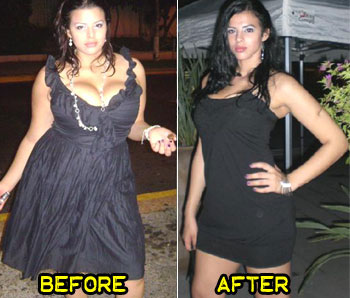 barbara-weight-loss-story-2