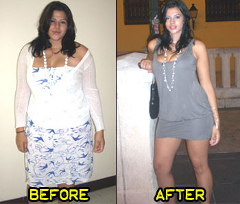 barbara-weight-loss-story-4