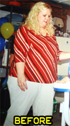 shanda-weight-loss-success-before