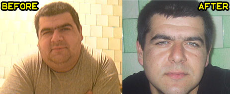 raduca-weight-loss-success-story