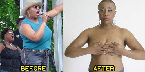 mekole-weight-loss-story-1